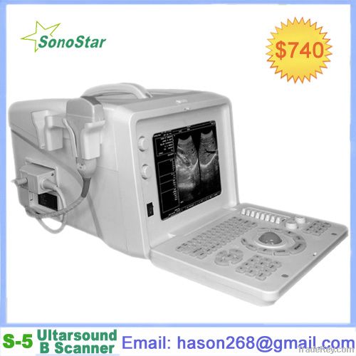 SS-5 Ultrasound Imaging Systems(ultrasound, ultrasoni, black white, scann