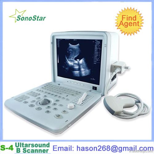 SS-4 Ultrasound Diagnosis B Scanner(ultrasound, ultrasoni, black white, s