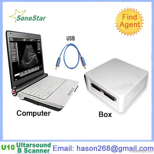 UBox-9 Ultrasound B Scanner Box(ultrasound, ultrasoni, black white, scann