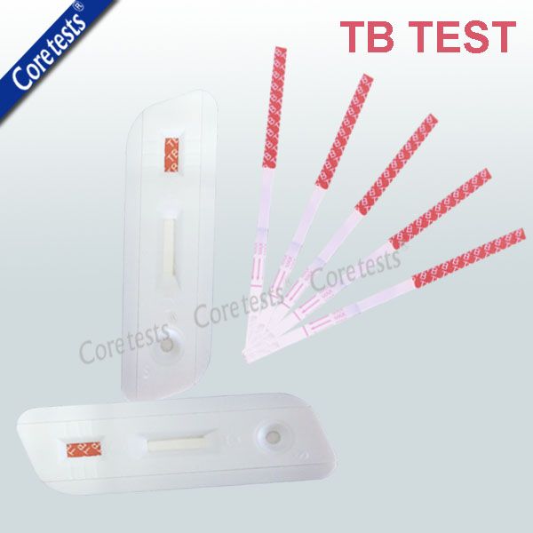 TB Tuberculosis Test 