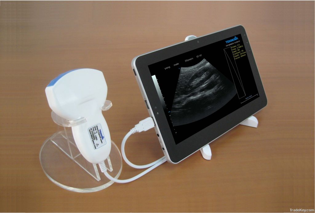 Tablet Ultrasound Diagnostic System