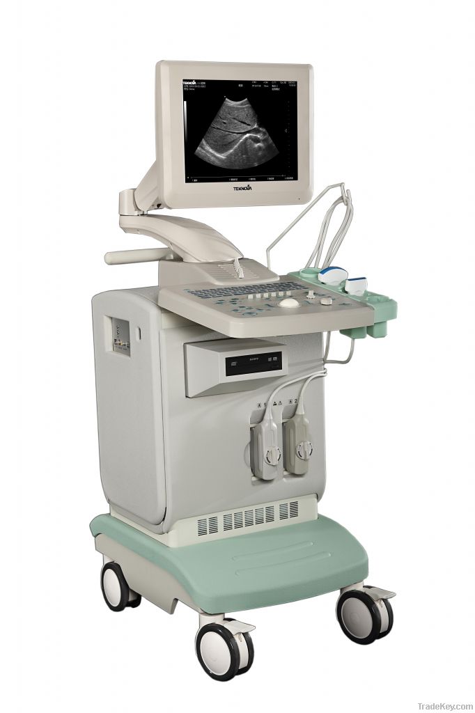 Full-digital Ultrasound Diagnostic System