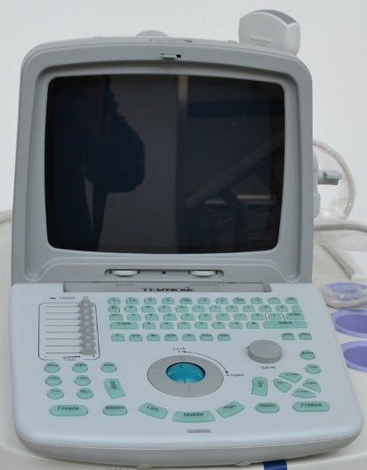 TH-80 Portable Ultrasound Diagnostic System