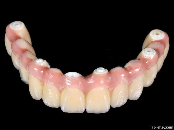 Denture (Procera Implant Bridge Zirconia)