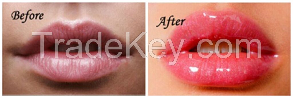 2015 Fashion Lip Pump Lip Enhancer for Natural Fuller Bigger / Thicker/Poutier Sexy Lips