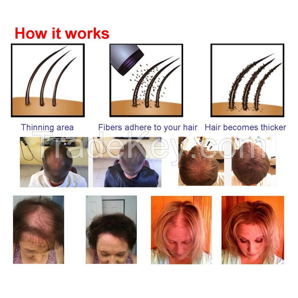 Hair Building Fiber Hair Loss Treatments for Hair Regrowth 27.5g/ 25g