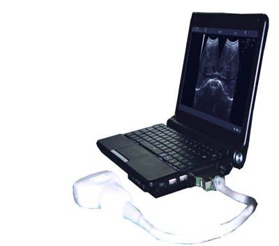 Portable Ultrasound