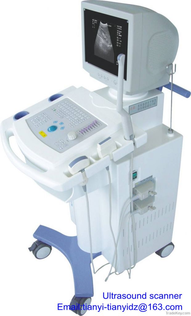 Trolley type digital ultrasound scanner