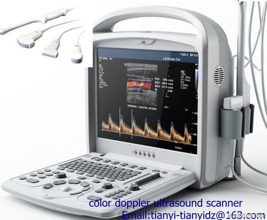 Portable/handheld Color Doppler Ultrasound Scanner