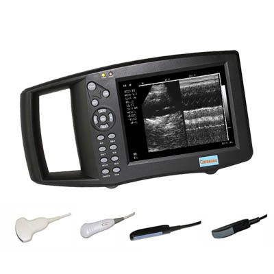 Palm HD9300A Ultrasound Scanner