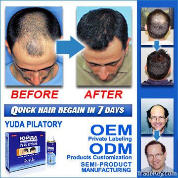 116- Herbal Hair Regrowth For Hair loss( male)