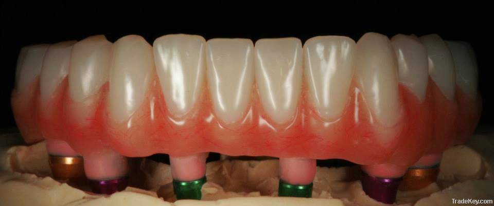 Removable Acrylic partials+Implant