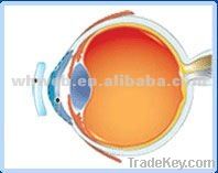 For moderate and high myopia/MCT lens/MCT Technology