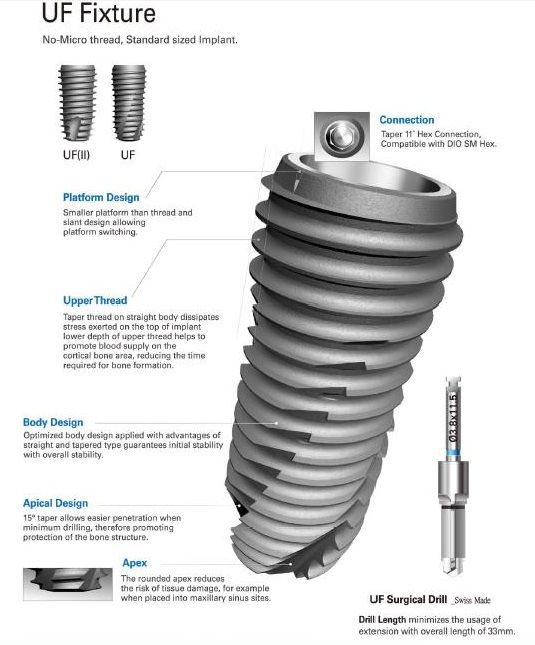 DIO dental implant