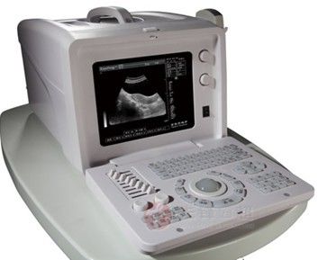 Full digital portable ultrasound machine scanner