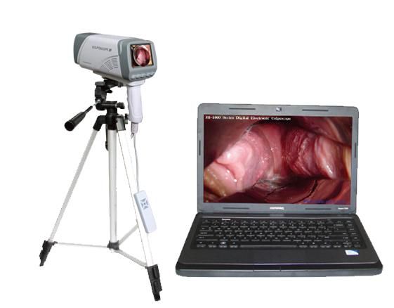 Laptop Digital video colposcope