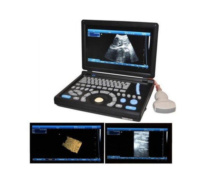 Laptop B/W ultrasound scanner with 3D function and PC