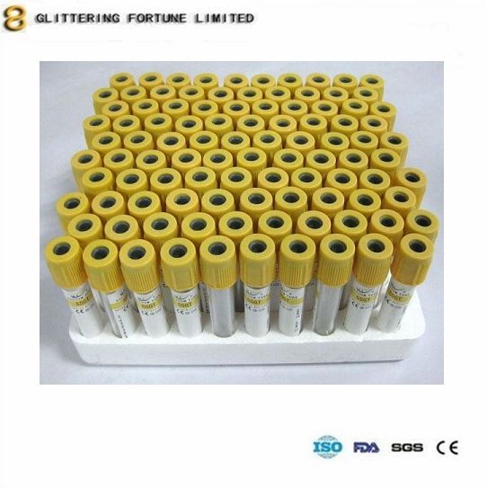 Serum Separation Tubes