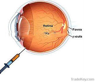 Ophthalmic Surgery--Hyaluronic Acid Injection Gel