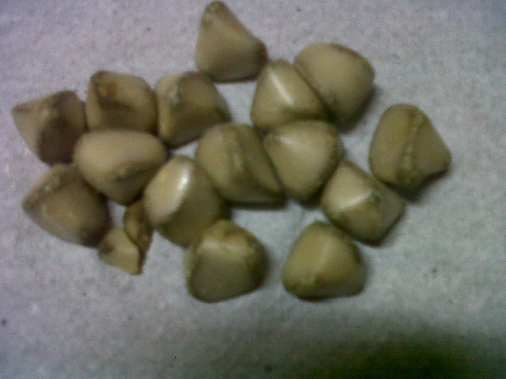 Human Gallstones for sale