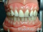 acrylic denture/teeth set up