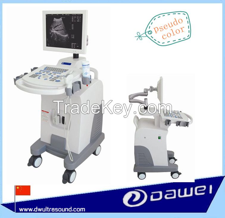 Trolley digital ultrasound machine &amp;amp; medical ultrasound equipment for obstetrics &amp;amp; gynecology