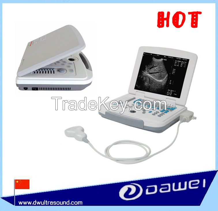 portable ultrasound scanner & price laptop ultrasound machine