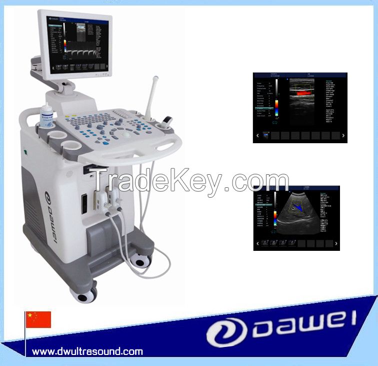 Trolley Color Doppler Ultrasound Machine & Medical Ultrasound Equipment