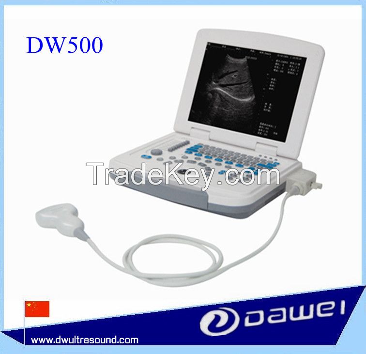 cheapest portable ultrasound machine&amp;laptop ultrasound scanner DW500