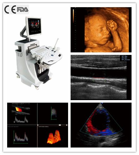 3D/4D  Color Doppler Ultrasound scanner