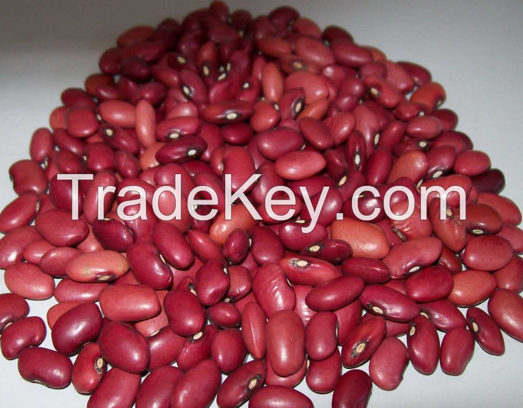 White and RED Kidney Bean.