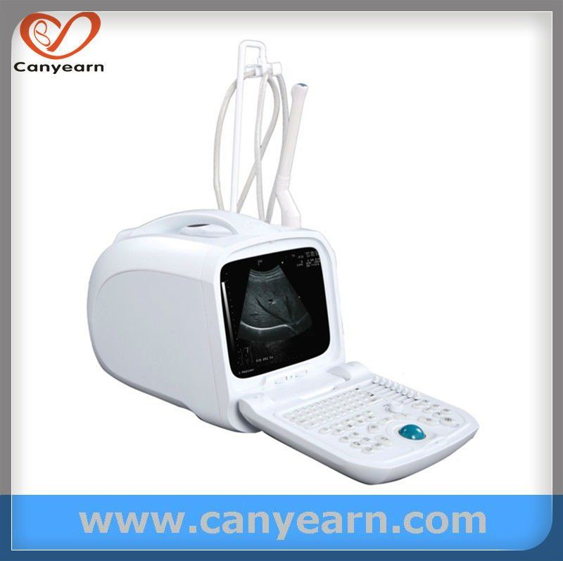 CE U630 Portable Ultrasound Apparatus