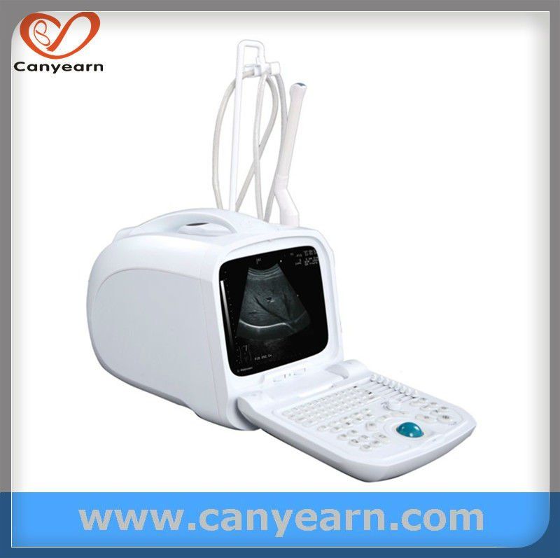 CE U630 OB/GYN Portable/Hand-carried Sonography Scanner