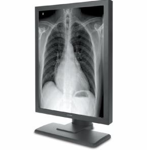 3MP Grayscale / Monochrome Medical Display (M32)
