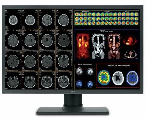 42" Dual Head LED Color Ct/Mr Medical Display (C42)