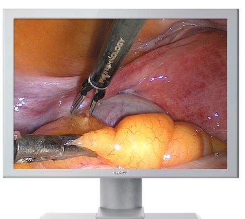 17-Inch Endoscopy and Surgical Display