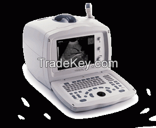 Mindray ultrasound machine Dp 2200