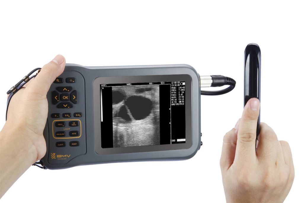 Portable vet ultrasound diagnosis scanner