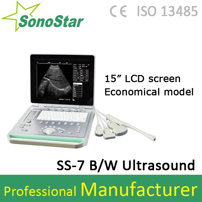 SS-7 Economical Laptop B/W Ultrasound Scanner