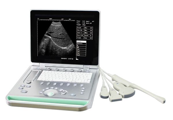 SS-7 Laptop Ultrasound Scanne