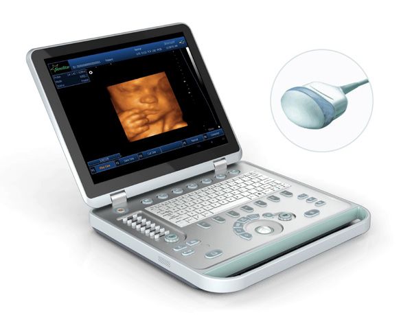 SS-10Plus 4D Laptop Ultrasound Scanner