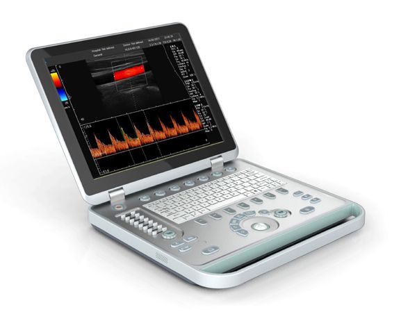 C5 Laptop Color Doppler Ultrasound System