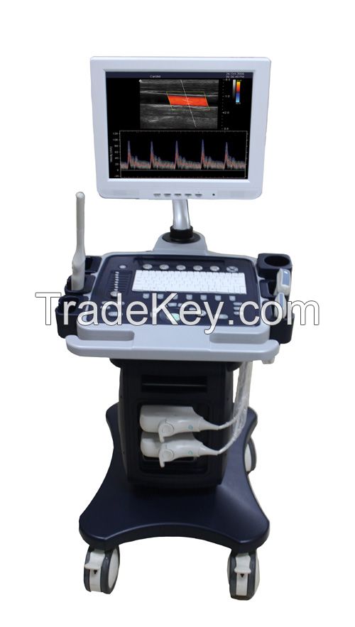 color doppler ultrasound machine with trolley