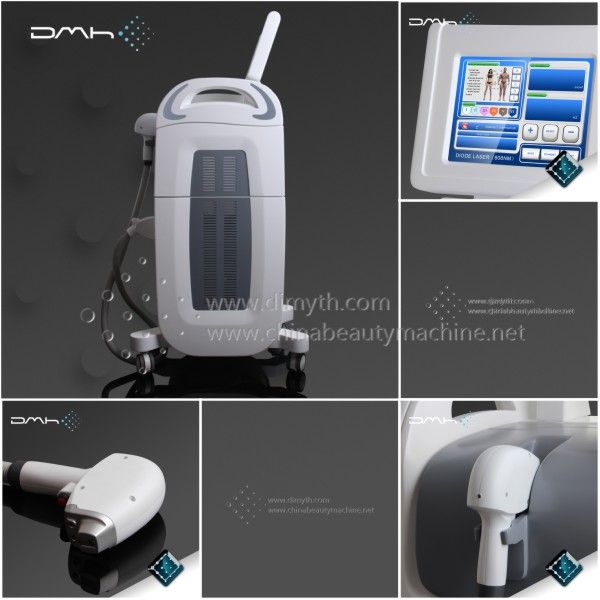 Painless Effective 808nm Laser Hair Removal Machine