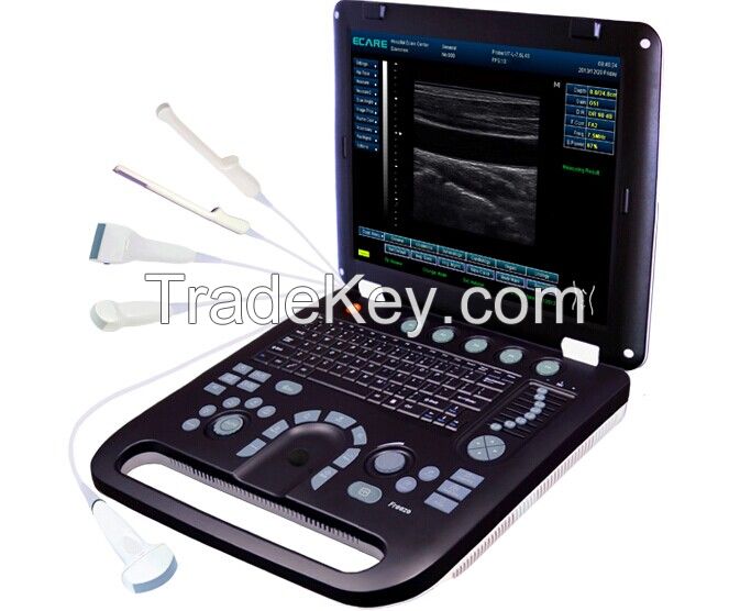 ultrasound,ecografos