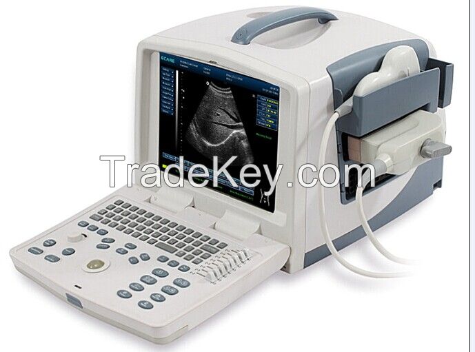 Ultrasound,ecografos