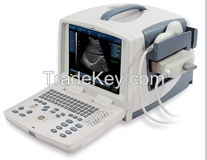 Ultrasound,ecografos