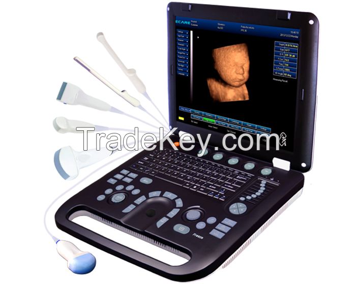 EC50B Laptop 4D Ultrasound System