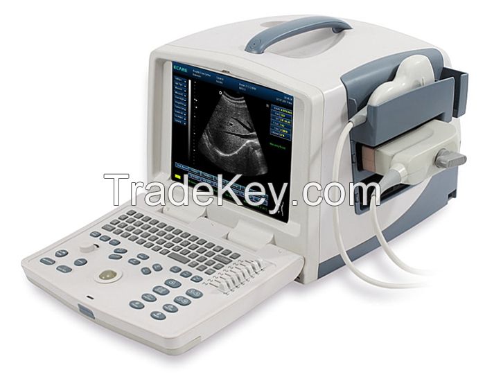 Ecare-3300/3500 Portable Ultrasound System