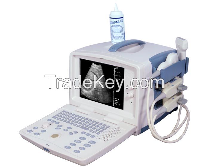 Ecare-3100 Portable Ultrasound Scanner